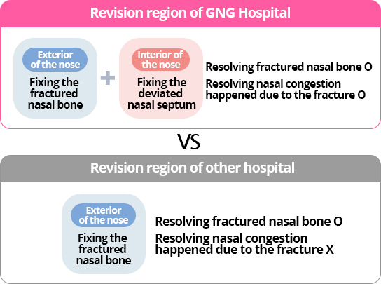 both the fractured nasal bone and      the deviated nasal septum