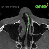 gnghospital media